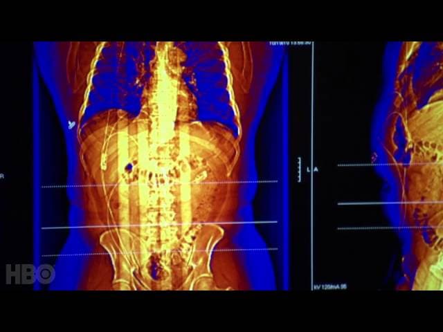 The Weight of the Nation: Part 1 - Consequences (HBO Docs) Thumbnail