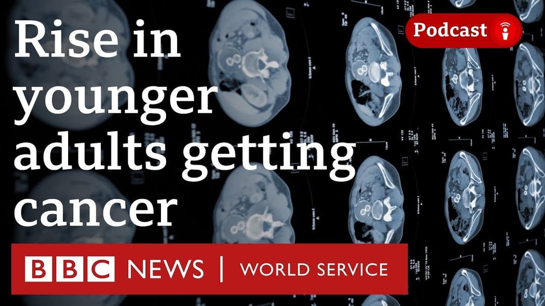 Why are more adults than ever getting cancer younger? - The Global Story podcast, BBC World Service Thumbnail